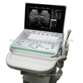 MSLPU25M Promotion Cheap Laptop ultrasound machine doppler ultrasound machine price